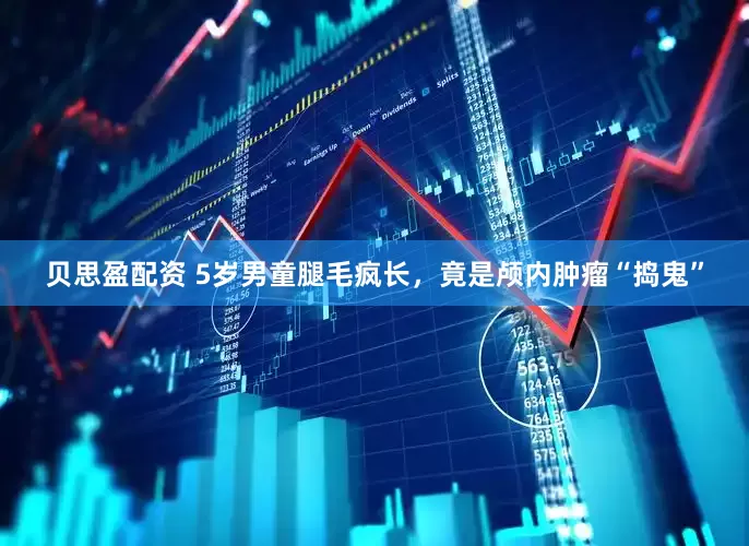 贝思盈配资 5岁男童腿毛疯长，竟是颅内肿瘤“捣鬼”